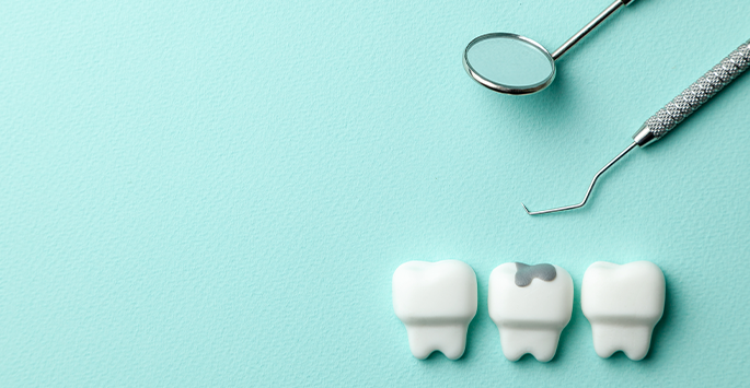 Which Dental Fillings Are Best for Tooth Decay?